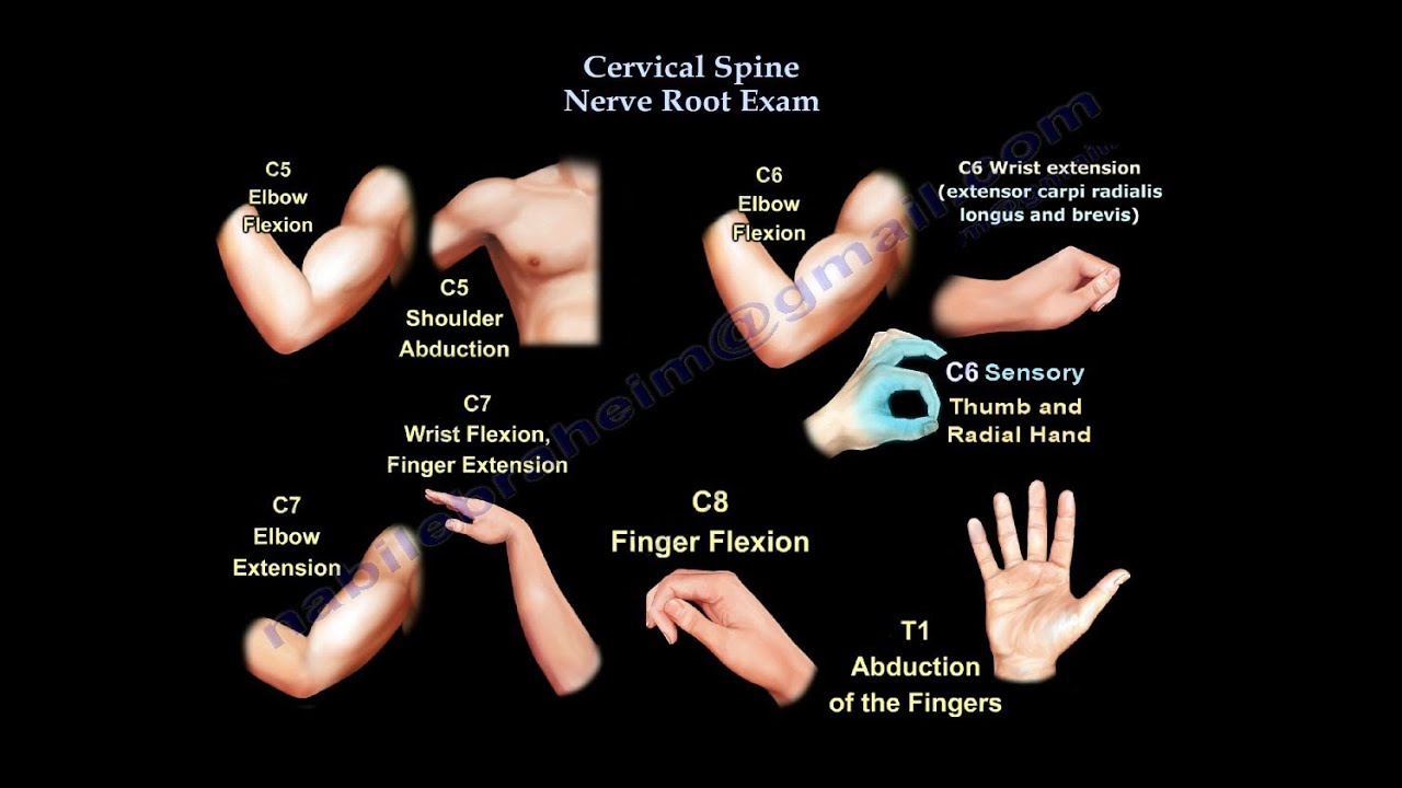 Cervical Spine Nerve Root Exam - Everything You Need To Know - Dr