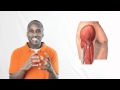 Cellular Adaptations Quiz