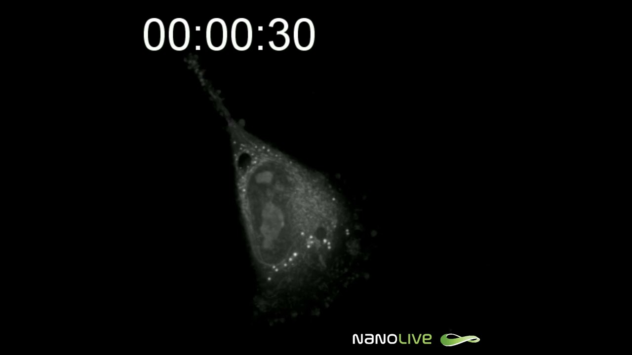 Label Free Live Cell Imaging Of Apoptosis T685A Human Melanoma Cancer