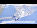 HEARTROID Coronary Model Cleanup Procedure