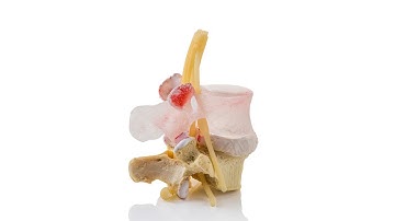 New Professional LxH Dynamic Disc Model - Product Video