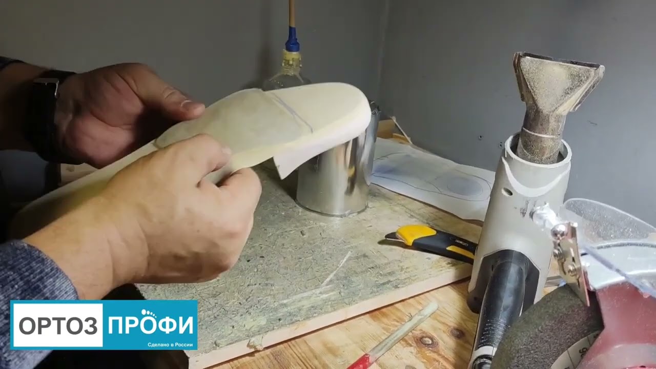 Ампутировали пол стопы?