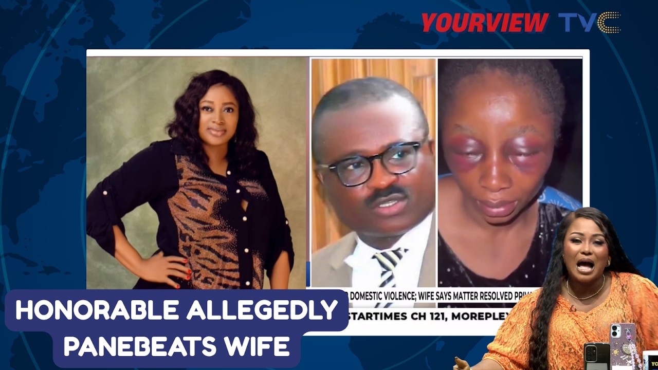 “A Leader Who Beats His Wife?” — Your View Ladies Slam Dickson Agbor’s Dishonorable Actions