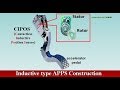 Accelerator Pedal Position Sensor (APPS) Types
