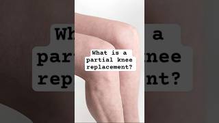 What is a partial knee replacement? #arthritis #doctor #health #orthopedic