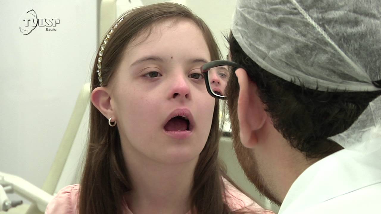 Programa 3x4: Doença periodontal em pessoas com Síndrome de Down