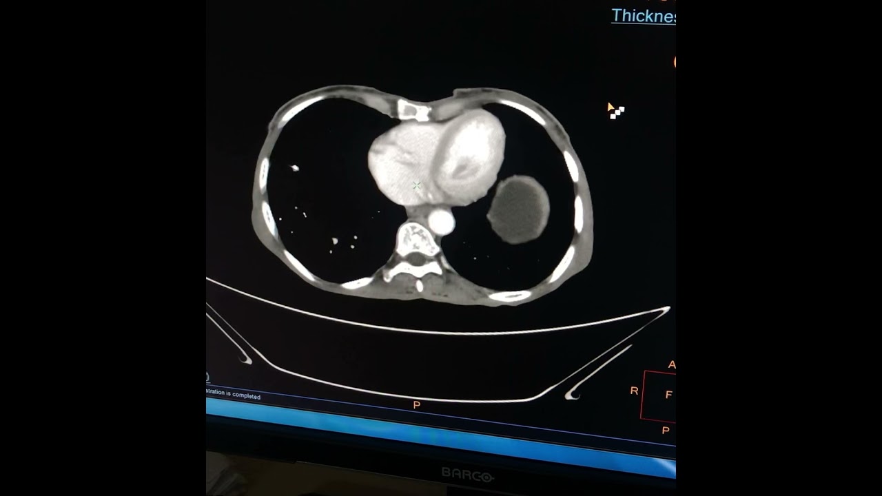 Exam cases radiology MD/Dnb