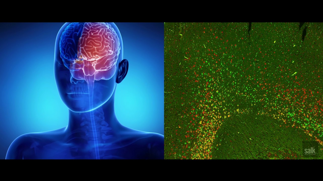 Salk scientists identify new brain cells