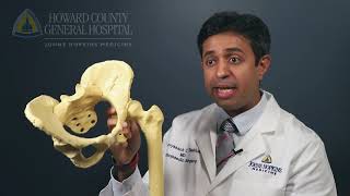 Q&A - Hip Fracture Treatment