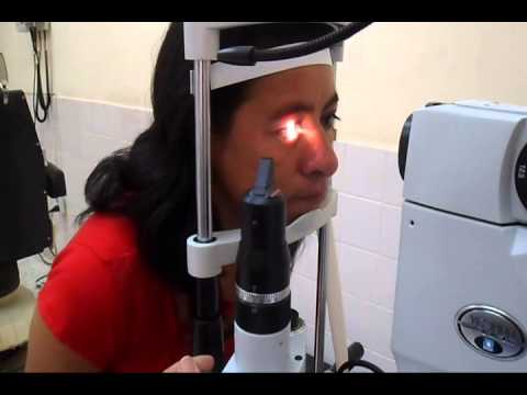 Demostración de la utilización del Yag Laser - YouTube