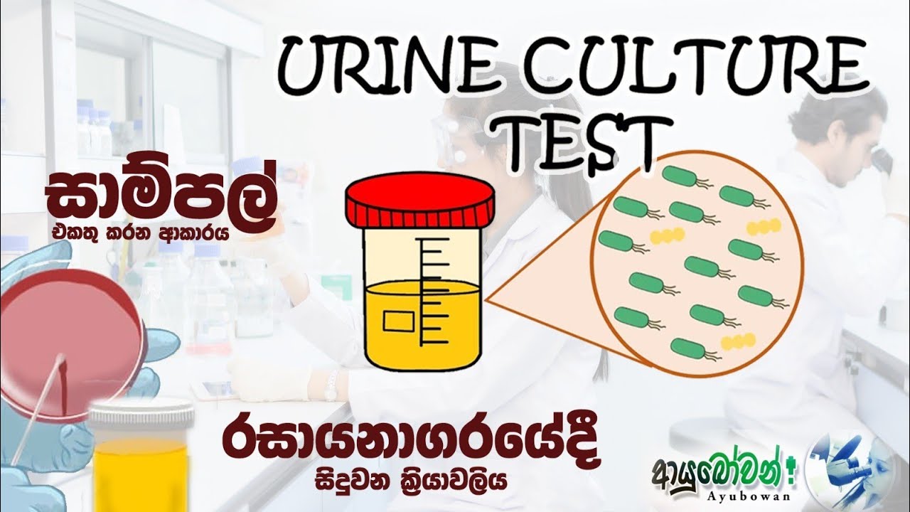 Urine Culture test එක ගැන සියලුම දේ දැන ගන්න YouTube