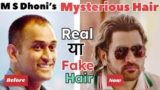 Mahindra Singh Dhoni Shoking Hair Transplant | Mahindra Singh Dhoni Hair Transformation