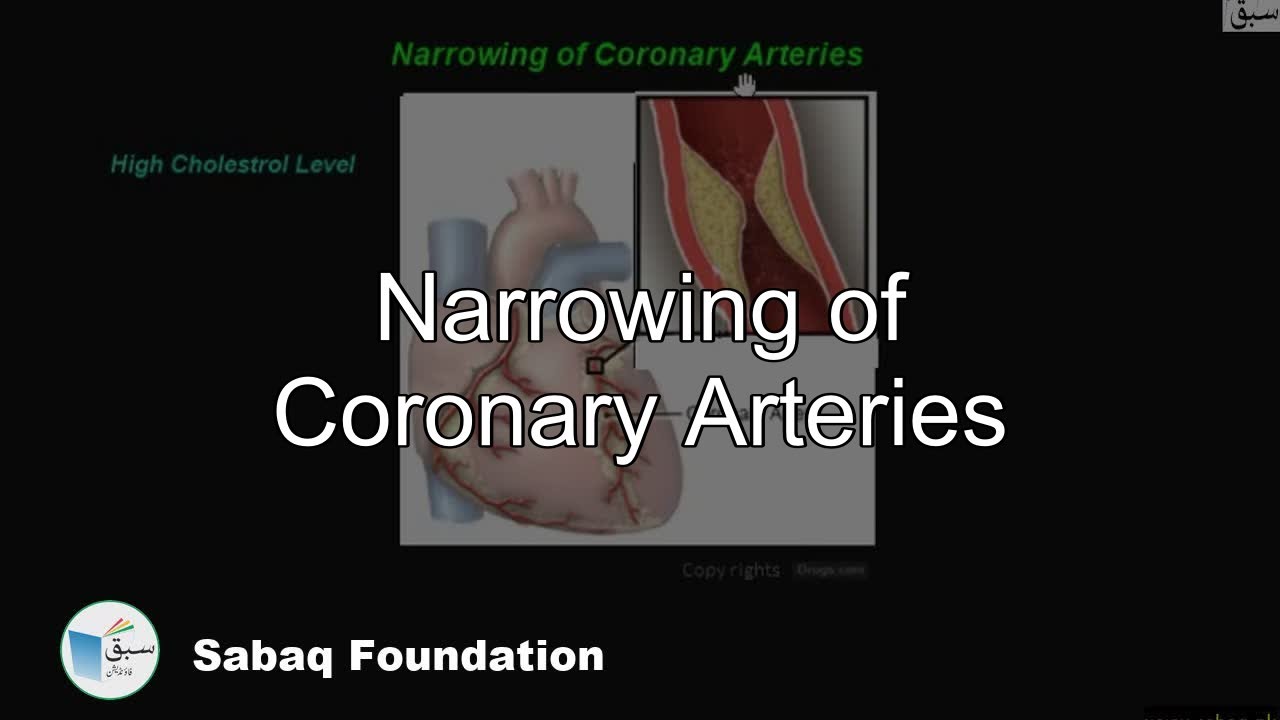 Narrowing of Coronary Arteries, General Science Lecture Sabaq.pk