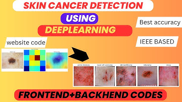 Skin Cancer Detection Using Deep Learning | Best ML Project 2025-26 | IEEE Paper Based Project