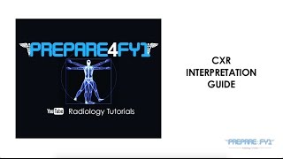 CXR Interpretation Guide