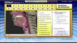 MBSImP Standardized Clinical Training and Reliability Testing