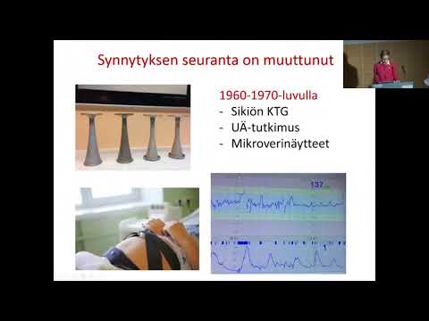 Video: Kuka oli ignaz semmelweis ja mitä hän teki?