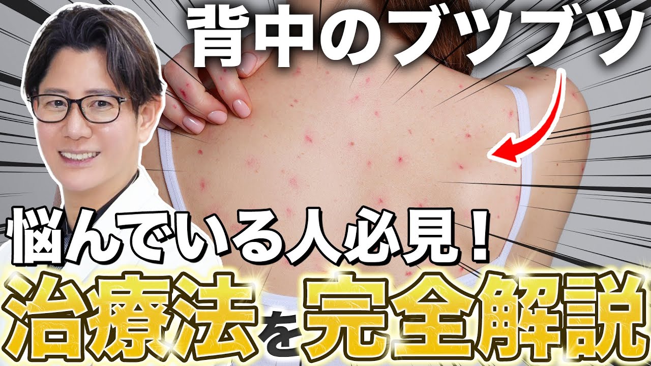 【背中のブツブツ】ニキビ？湿疹？それとも•••原因と治療方法を現役皮膚科医が解説