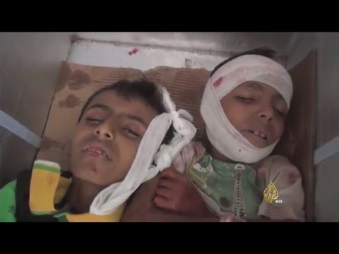 مطالبات يمنية بتدخل دولي لوقف مجازر الحوثيين بتعز