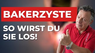 Du hast eine Bakerzyste? So kannst du dir selbst helfen!