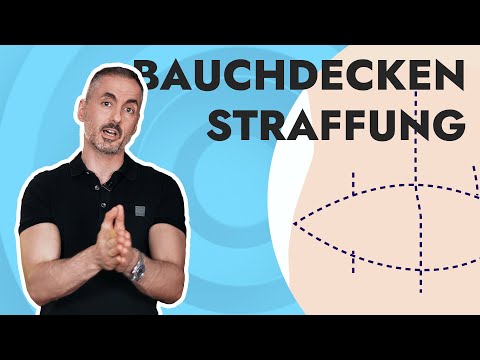 Your Plastic Surgery Coach – Labbrite abdominal wall? All about the tummy tuck.