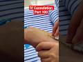 😲 Doctors bhi shock! Aisa Cannula pehle kabhi nahi dekha 🔥 #shorts #viral #hospital #ivcannulation