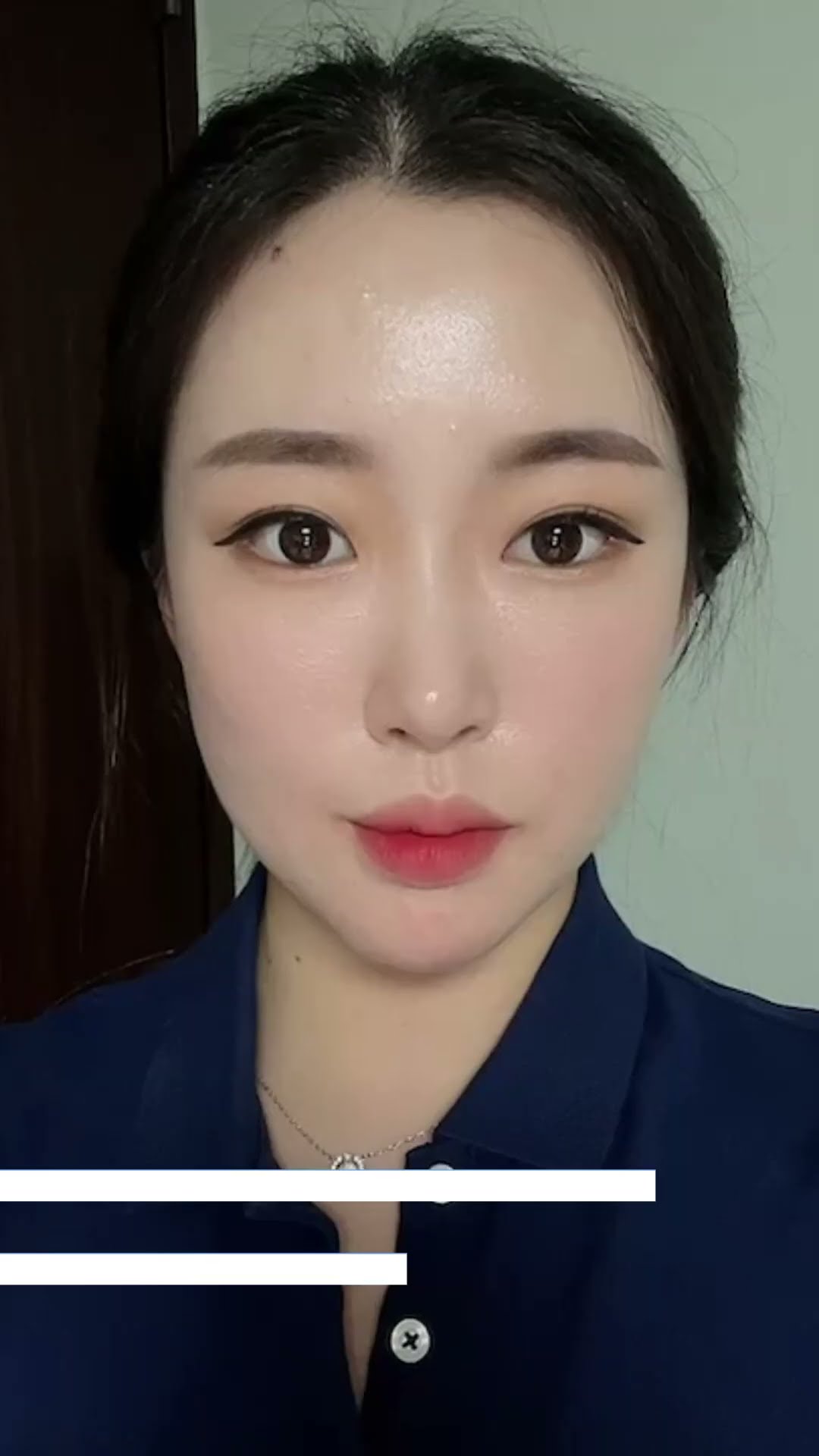 double Eyelid Surgery Before & After in Korea 💜