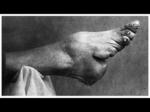 The Real Reason Why Chinese Women Bound Their Feet