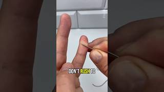 Celebrity Easy Splinter Removal Hack Net Worth