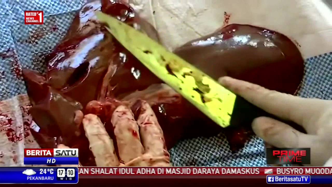 Unduh 730 Koleksi Gambar Hati Sapi Yang Ada Cacingnya  Gratis