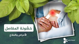 خشونة المفاصل .. الأعراض والعلاج || كبسولة عشبية