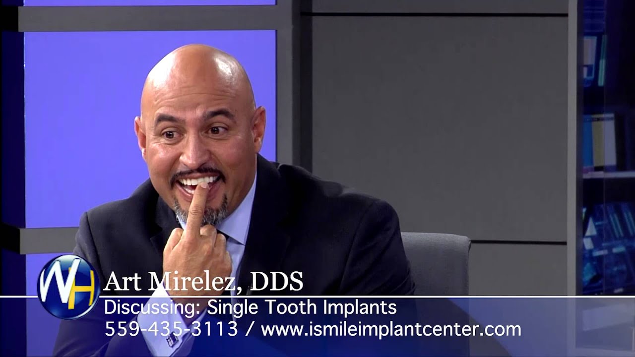 Single Tooth Implants with Fresno, CA Dentist Art Mirelez, DDS YouTube