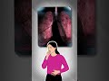 Stop calling it "Drama"—Your Lungs are under ATTACK! 🛑💨