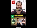 Best and Worst Hair Loss Treatments