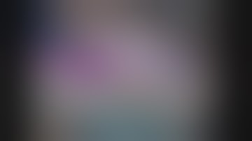 Trans Conjunctival SICS vectis assisted nucleus delivery