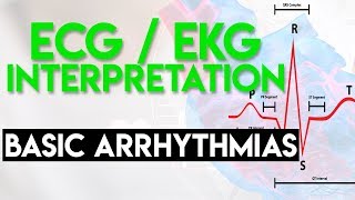 Basic Arrhythmias | Sinus, Brady, Tachy, Premature Beats | ECG EKG Interpretation (Part 3)