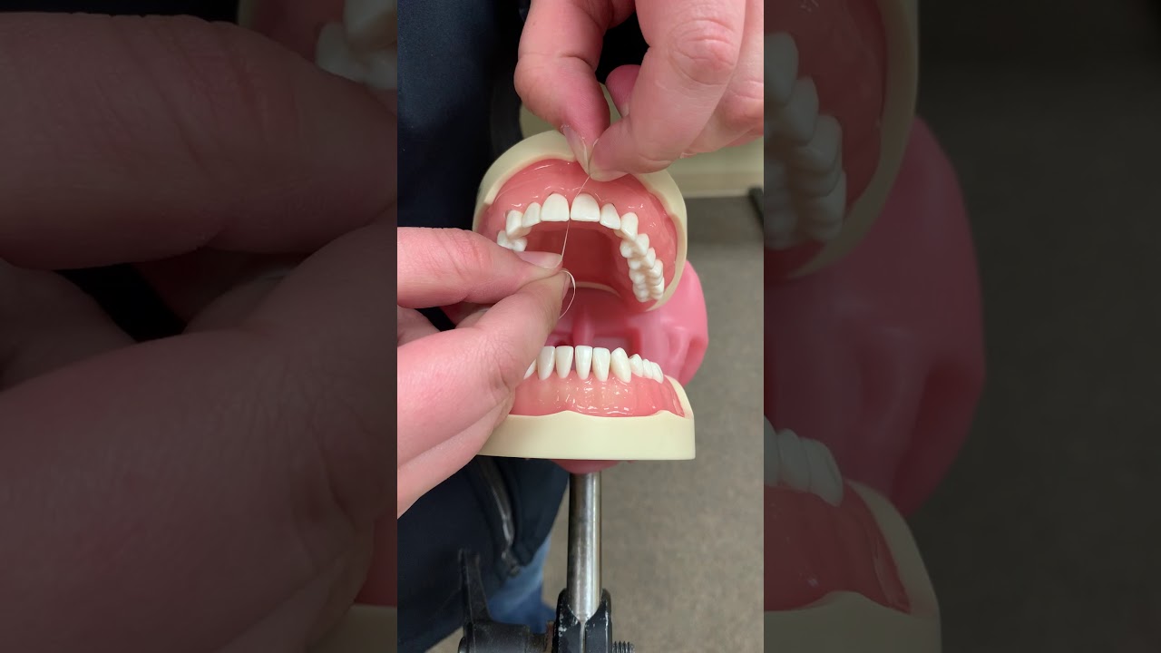 Flossing 