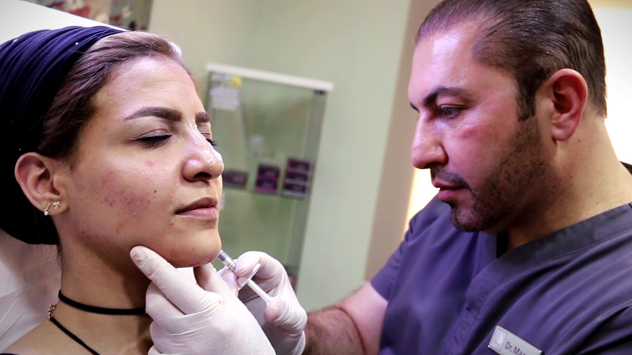 حقن البوتكس للتجاعيد في الجبهة و حول العينين مع حقن الفلر في الخدود