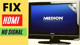 MEDION TV HDMI NO SIGNAL || HDMI NO SIGNAL ON TV