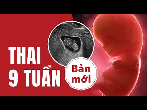 Video Thai 9 Tuần Phát Triển Như Thế Nào? - youtube