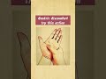 Neet UG Students MCQ Questions And Answers Bsc Nursing #youtubeshorts #ytshorts #shortvideo #shorts