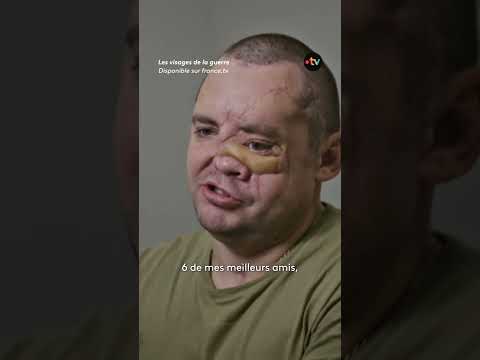 Cette chirurgienne répare les "gueules cassées" de la guerre en Ukraine
