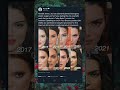 Kendall Jenner Addresses Cosmetic Surgery Speculation 👀#KendallJenner #CelebrityDrama
