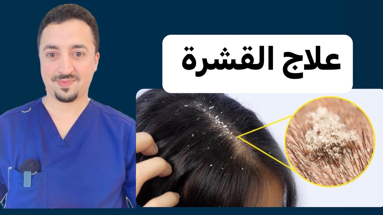 أقوى شامبوهات لعلاج القشرة نهائياً بجميع أنواعها