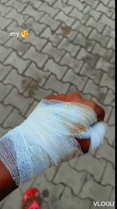 hath Kata hua status 😔 blood status 😔 bandge status sad WhatsApp status #youtubeshorts #sadstatus
