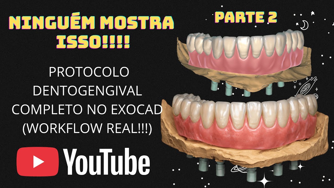 NINGUÉM MOSTRA ISSO !!!!! PROTOCOLO DENTOGENGIVAL COMPLETO NO EXOCAD (WORKFLOW REAL ) PARTE 2