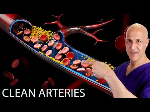 #1 Way to Correct/Prevent Insulin Resistance, Clogged Arteries, Heart Attack & Stroke | Dr. Mandell