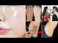 Top 9 Life Saving Hacks for Glass Skin,Fairer Hands,Whiten Underarms | अब Skin के सारे प्रॉब्लम ख़त्म