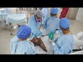 General Anesthesia for Jaw Surgery - Intubation