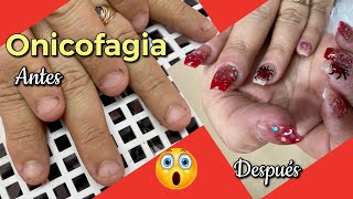 Como aplicar Acrilico sobre UÑAS con ONICOFAGIA 💅Cambio Total/Trabajo en CLIENTA